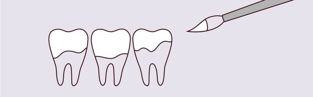 Dreamscape Imagery 01 1024x318 1 Matias Dental Group