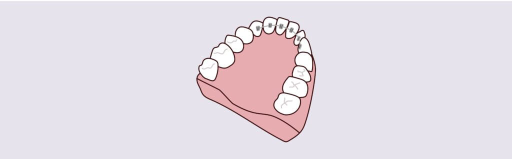 Dreamscape Imagery 09 1024x318 1 Matias Dental Group