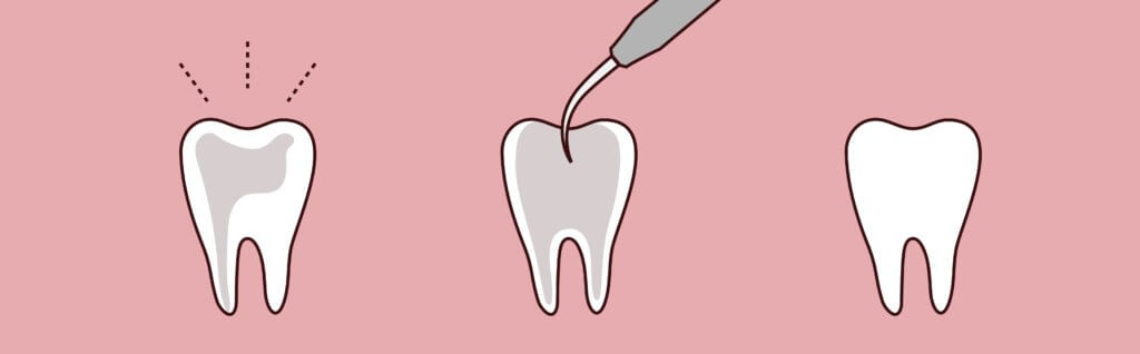 Dreamscape Imagery 10 1024x318 1 Matias Dental Group