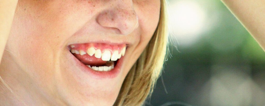 Root Resorption 1024x410 1 Matias Dental Group